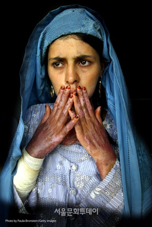 ▲절박함으로 분신자살을 시도한 헤라트 여성 2004.10.22 ⓒPhoto by Paula Bronstein, Getty Images